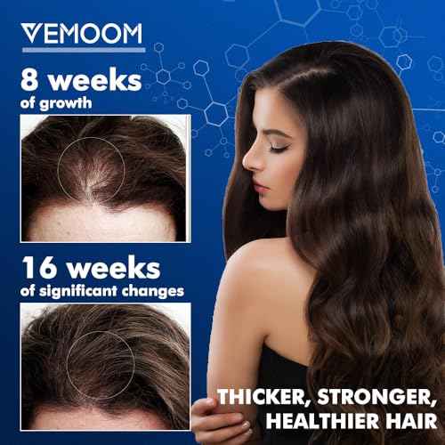 5% Minoxidil Hair Growth Spray for Women and Men, Effective Anti-Hair Loss Treatment for Regrowth, Extra Strength Scalp Solution, Thicker, Stronger and Longer Hair - 60ml*2