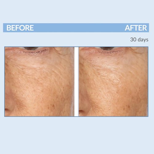 Serious Skincare A Force XR Serum Retinol Concentrate - Vitamin A - Time Released – Lightweight Anti-Aging & Anti-Wrinkle Facial Treatment – Green Tea Leaf Extract - 2 oz.