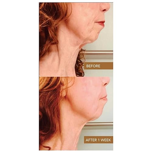 Cleopatra Neck Cream, 2oz ? Firming & Lifting Neck Moisturizer with Colloidal Gold, Silk Peptides & Green Tea ? Organic, Vegan ? Reduces Wrinkles & Improves Elasticity