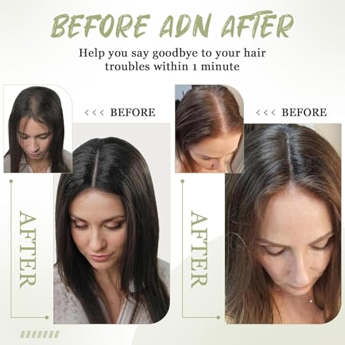 Urbeauty Hair Toppers for Women Real Human Hair for Thinning, 16 inch 1.5¡±x5¡±Silk Base Upgrade Topper, Clip-in Volume Enhancer, Natural-Looking, No Glue, Breathable, Lightweight