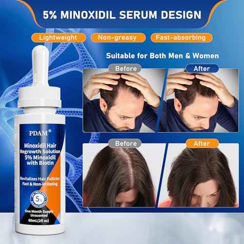 5% Minoxidil for Men Hair & Beard Growth Kit, Minoxidil for Women Hair Growth Serum, Extra Strength Hair Loss Treatment for Thinning Hair, Promotes Thicker Fuller Regrowth, Nourishes Scalp, 3 ¡¿ 2oz
