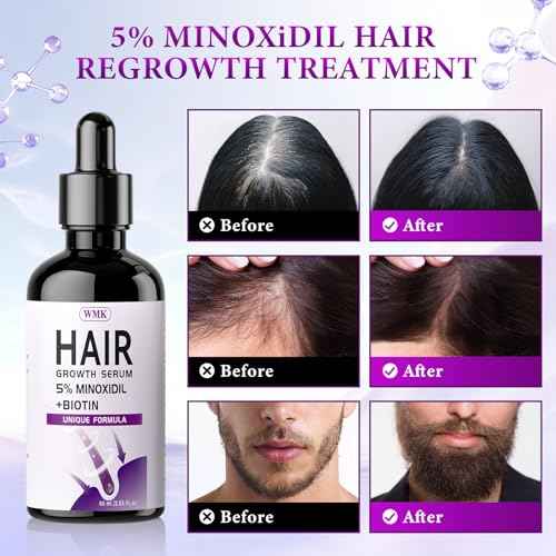 5% Minoxidil for Men and Women Hair Growth Oil, Biotin Hair Serum, 2.03 fl oz