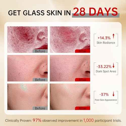 VGO Skin Care Set, with Snail Mucin 92% Moisturizer 1.76 Oz & Vitamin C Face Serum 1.01 Oz, Daily Hydrating & Firming Skincare Routine Kit for All Skin Type