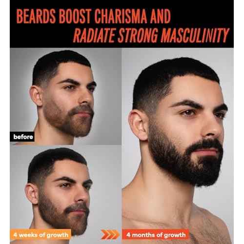 5% Minoxidil Beard Growth Oil for Men: Minoxidil for Men Beard Hair Regrowth Serum with Biotin and Caffeine - Unleash Your Wildness with Stronger Thicker Fuller Beard 2 FL OZ/60mL