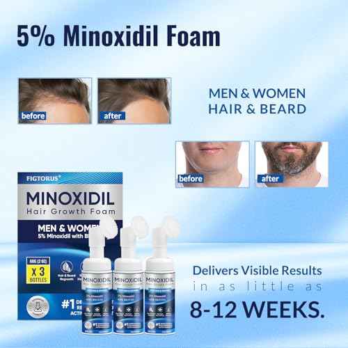5% Minoxidil Foam 3PCS, Minoxidil for Men Foam, Minoxidil for Women Hair Growth, Minoxidil for Men and Women.