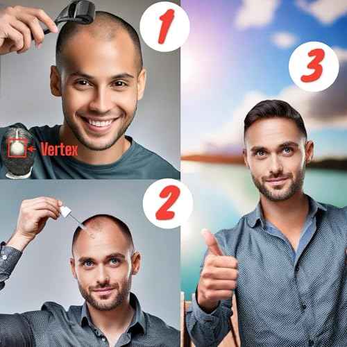 (6 Pack) Kirkland Minoxidil for Men Hair Regrowth Treatment, Liquid Extra Strength 5% Topical Solution, 6 Months Supply - Dropper Applicator and Microneedle Roller Included - Minoxidil Kirkland