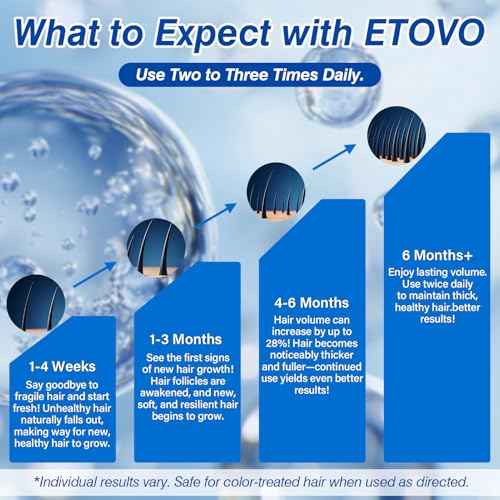 5% Minoxidil for Women Hair Growth Spray Serum Topical Minoxidil Hair Regrowth Thicker Prevent Hair Loss for Thickening Longer Fuller Healthier Hair 3 Bottles of 2oz