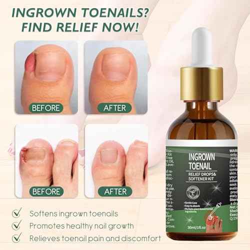 Ingrown Toenail Treatment ? 30ml Softening & Conditioning Kit for Easy Trimming with Silicone Gel Toe Caps ? Comprehensive Ingrown Toenail Removal Solution