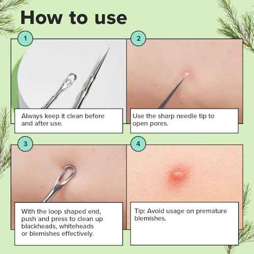 I DEW CARE Dual-Tip Pimple Tool - Proper Popper | Blackhead Remover, Blemish Exfoliating, Professional Acne Squeezer, Comedone Zit Extractor for Women, 2in1 Stainless Steel Lancet, 1ea