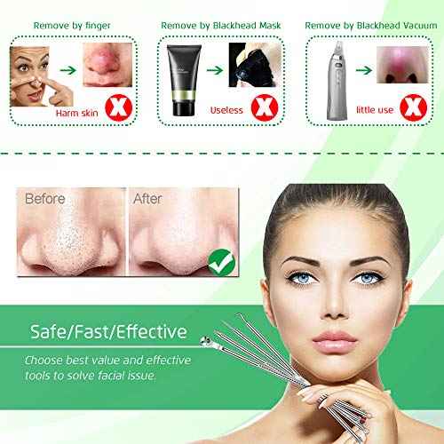 5PCS Blackhead Remover Comedone Extractor, Curved Blackhead Tweezers Kit, Professional Stainless Pimple Acne Blemish Removal Tools Kit for Manual