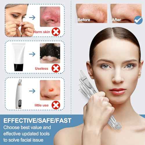 60PCS Dual Heads Blackhead Remover, Pimple Comedone Extractor, Acne Whitehead Blemish Removal Kit, Premium Stainless Steel Pimple Popper Tool kit, Risk Free for Face Skin, with Portable Box