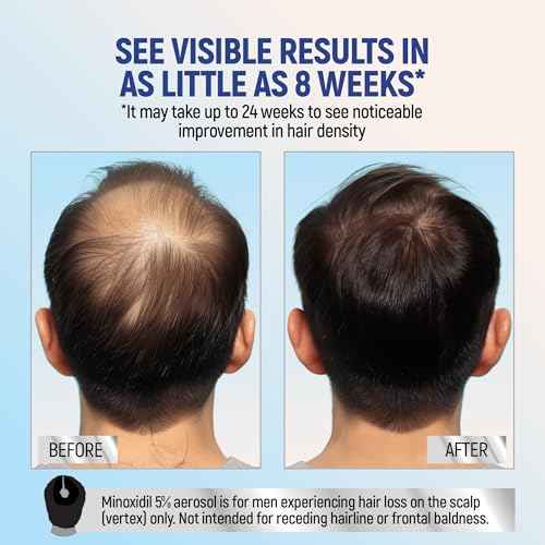 Taro Minoxidil topical aerosol foam, 5%, hair regrowth 2 months treatment for men, 2.11 oz (2 Pack)