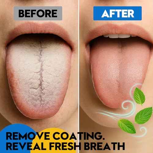 Stainless Tongue Scraper Set for Adults£º Easy To Use For Oral Care and Hygiene ? Pack Of 2 Stainless Steel Tongue Cleaners, 2 Travel Cases, 4 Floss Picks ? Cleaning for Tongue Care & Fresh Breath