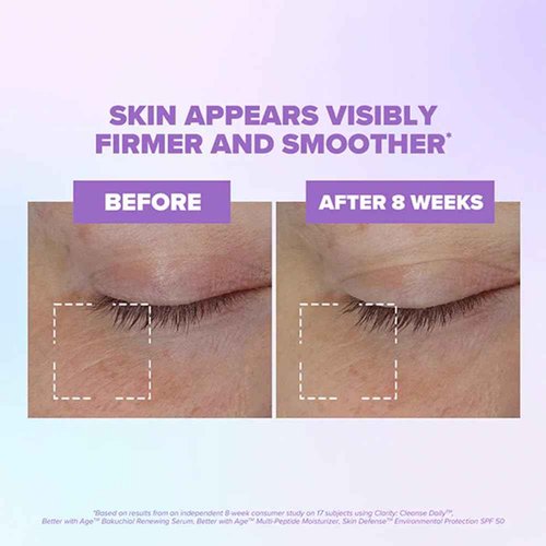 ClarityRx Better With Age Renewing Bakuchiol Face Serum for Anti-Aging, Gentle Alternative Retinol Serum, Plant Based, Cruelty Free, Paraben Free (1 fl oz)