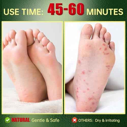 Foot Peeling Mask, Natural Exfoliating Foot Mask, Dead Skin Callus Remover Repair Heels, Hydrating Foot Care for Dry Cracked Feet£¨3 PacK£©