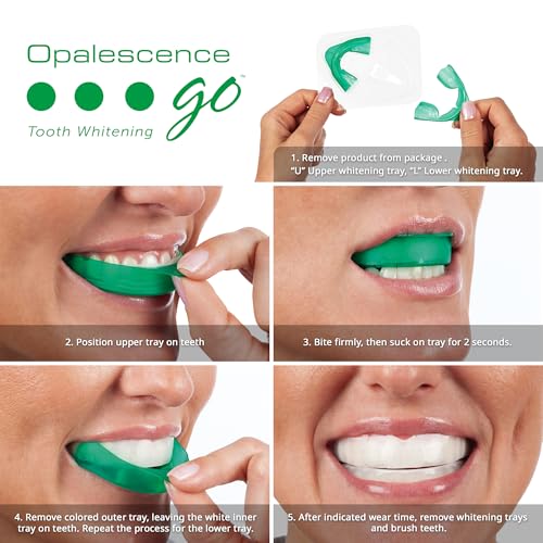Opalescence Go 15- Prefilled Teeth Whitening Trays - 15% Hydrogen Peroxide - (10 Treatments) Made by Ultradent Products. Teeth Whitening Kit -Mint - 5194-1