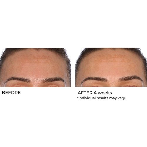 NassifMD Hydro-Gel with Hylauronic Acid Moisturizer, Salicylic Acid Serum, Retinol Serum for Face