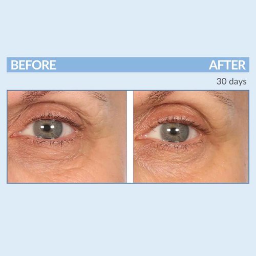 Serious Skincare - Eyetality PM Eye Night Cream with Resveratrol - Keratin & Lash Boosting Peptides for Thicker, Longer Lashes - Antioxidant-Rich to Treat Under Eye Signs of Aging 0.5 FL.Oz.