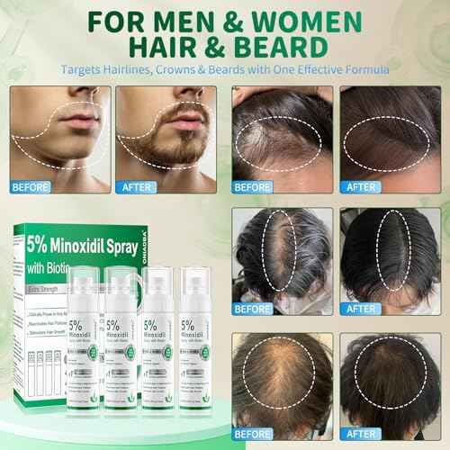 5% Minoxidil Spray for Hair Growth, 4 Pack (8.12oz), For Men & Women ? Extra Strength Hair Regrowth Treatment with Biotin & Castor Oil, Supports Thicker Fuller Hair & Beard, Non-Greasy 4-Month Supply