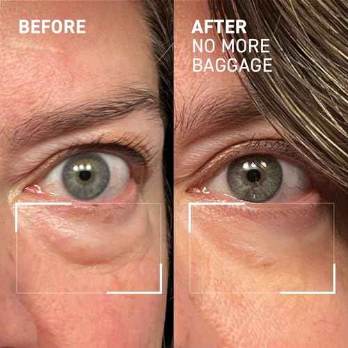 Dr. Brandt Needles No More, No More Baggage - 0.5 oz, Pack of 2 - Minimizes Under-Eye Bags, Puffiness & Dark Circles