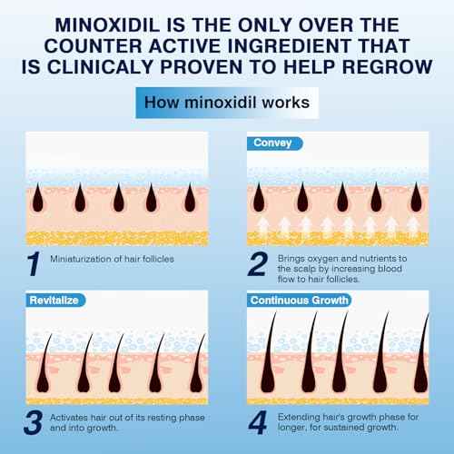 5% Minoxidil Foam? Hair Regrowth Treatment for Men & Women, Prevents Hair Thinning & Strengthens Roots, Minoxidil Foam for Fuller, Healthier Hair