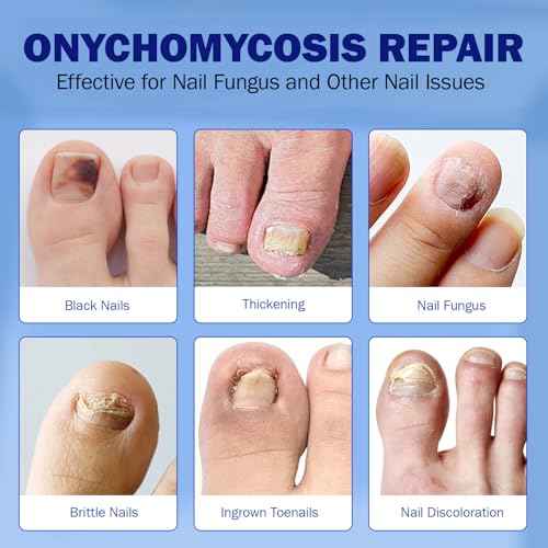 Fungal Nail Patches for Toenails, 21 Count - Nail Repair Patches with 8-Hour Adhesion, for Discolored & Damaged Toenails Care, Overnight Renewal for Men & Women