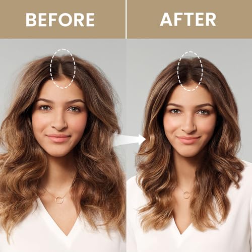 VOLLUCK Root Touch up Powder, Instant Hairline Powder for Thinning Areas and Gray Hair Coverage, Natural and Non-greasy Root Cover up for Women and Men (Dark Brown, 0.14 Ounce)