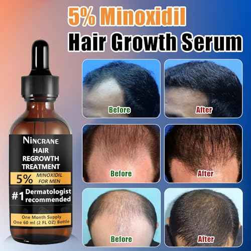 Minoxidil for Men 5% ? Hair Regrowth & Beard Growth Kit ? Extra Strength Hair Loss Treatment ? Topical Minoxidil for Facial Hair & Scalp ? 60ml