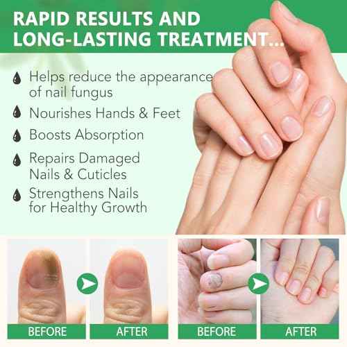 Ginger Nail Growth Strengthener Serum ? Ginger-Infused Nail Repair Oil for Care, Natural Nail and Strengthener Solution