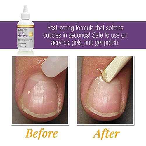 ProLinc Cuticle Eliminator, Softens and Removes Cuticles in Seconds, 4 oz