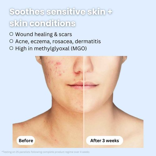 New Pacific Skincare Manuka Honey 45+ MGO & Bee Venom Day Cream | 100% Natural Firming Anti-Wrinkle Face Moisturizer with Hyaluronic Acid & Vitamin C | 2oz