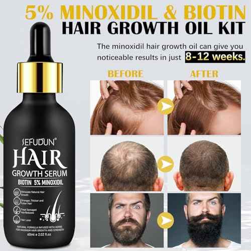 5% Minoxidil for Men and Women with Derma Roller, Hair Growth Serum & Beard Growth Kit, Minoxidil Biotin Hair Regrowth Treatment for Thicker, Fuller Hair - Stop Scalp Hair Loss & Thinning - 2.02 oz