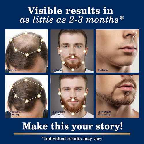 5% Minoxidil Hair Growth for Men and Women Spray Kit : Regrowth Topical Solution for Beard - Extra Strength Treatment Serum with Biotin for Hair loss & Thinning - 2PCS