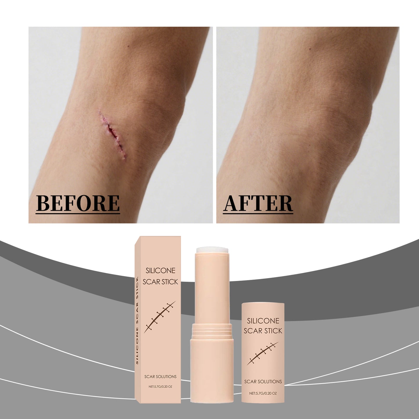 Scar Gentle Care Stick - Body Care 5.7g for Skin Healing & Scar Reduction