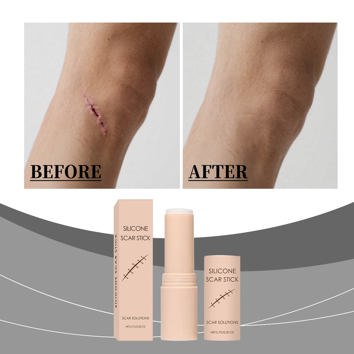 Scar Gentle Care Stick 5.7g
