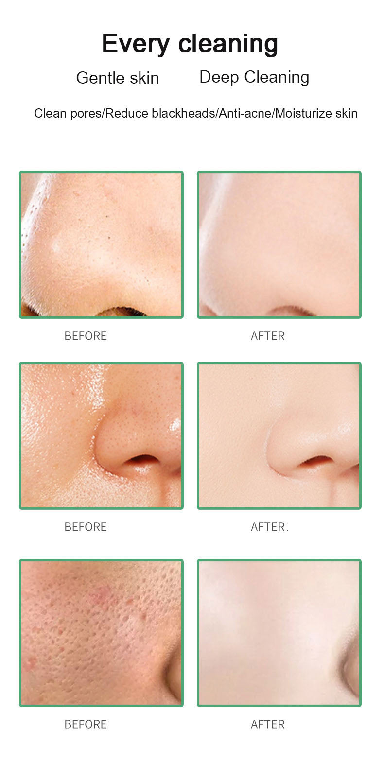 Green Tea Mud Mask Stick - 40g Deep Cleansing Facial Treatment