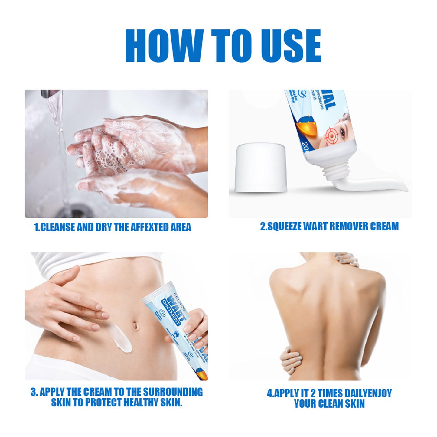 Skin Blemish and Wart Removal Cream - Natural Herbal Formula