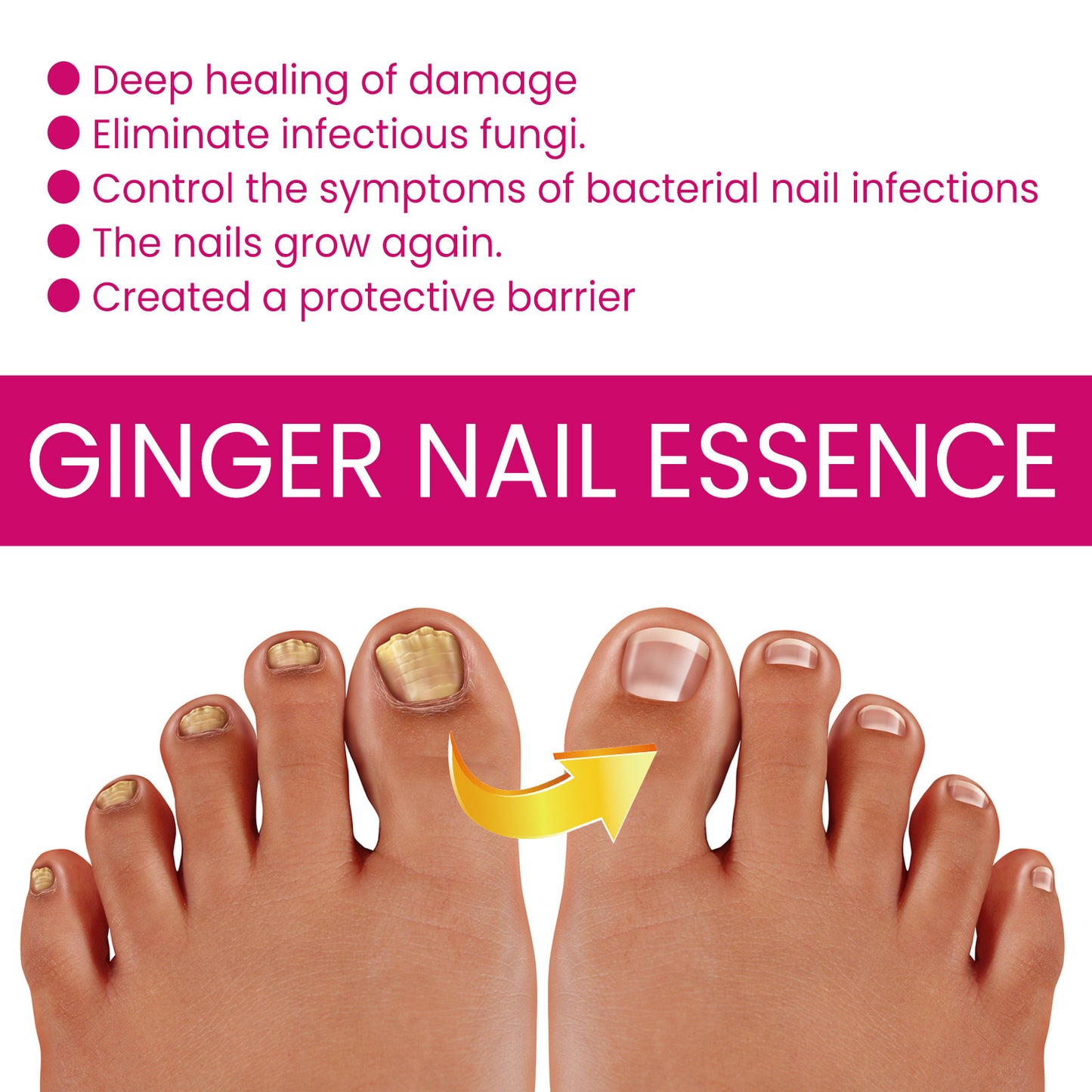 Nail Care Ginger Essence - Moisturizing Nail Treatment 10ml