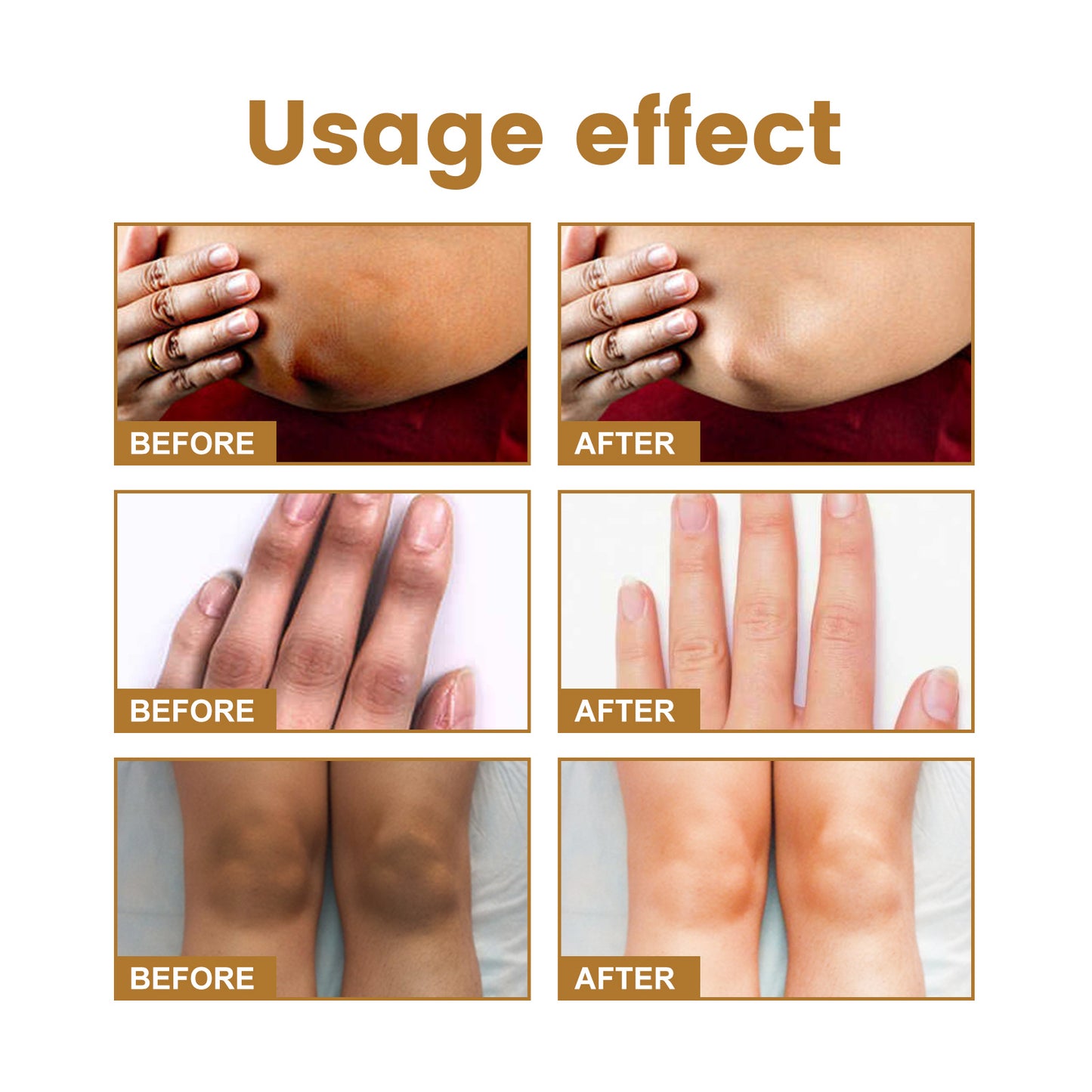 Knuckle Dark Spot Corrector Serum - Melanin Whitening & Moisturizing Treatment