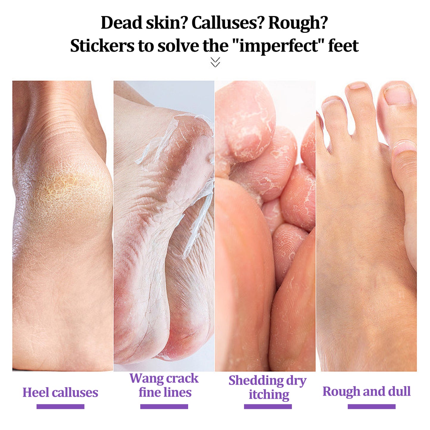 Ginger Foot Mask for Exfoliating and Moisturizing Dry Cracked Skin
