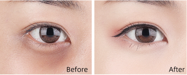 Full Coverage Concealer for Blemishes Dark Circles & Tattoos - 14g