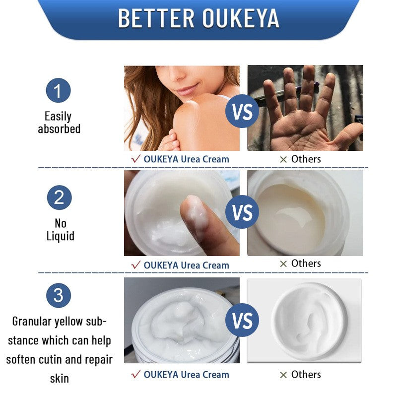 Urea Cream 150g for Skin Care, Moisturizing Body Lotion