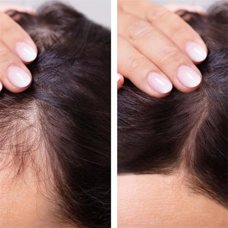 Ginger Hair Nutrient Oil – 20ml
