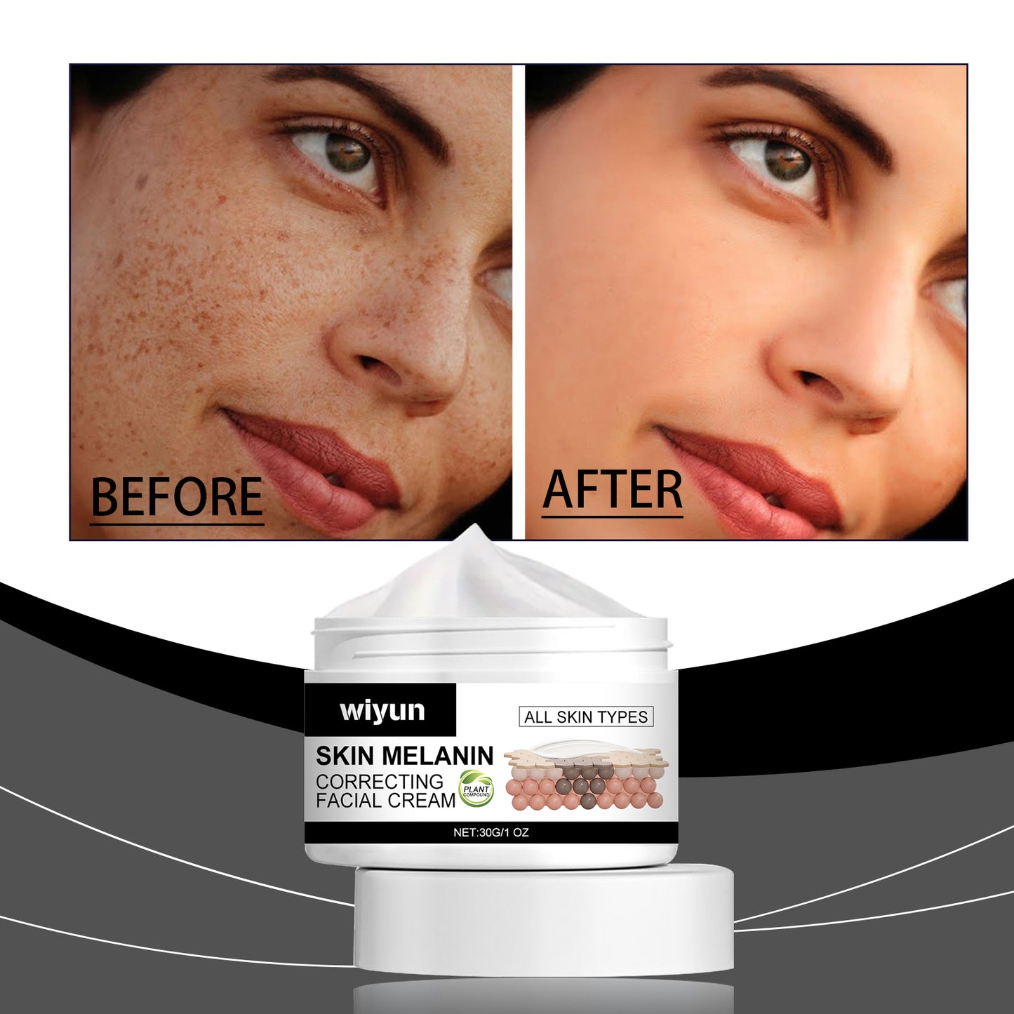 Portable Laser Dark Spot Remover for Face - Skin Rejuvenation Tool