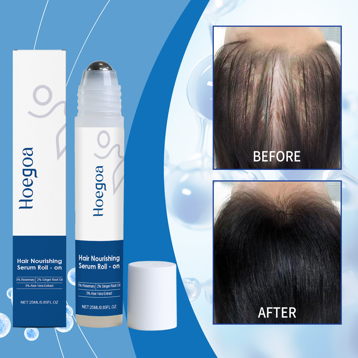 Hair Growth Roll-On - 25ml Body Care for Hair Loss & Regrowth