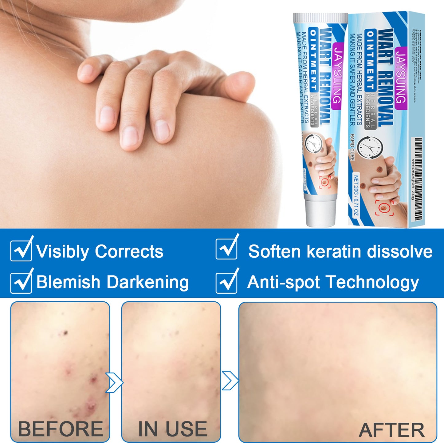 External Body Skin Care Paste - Universal, 20g Natural Emulsifiable Treatment