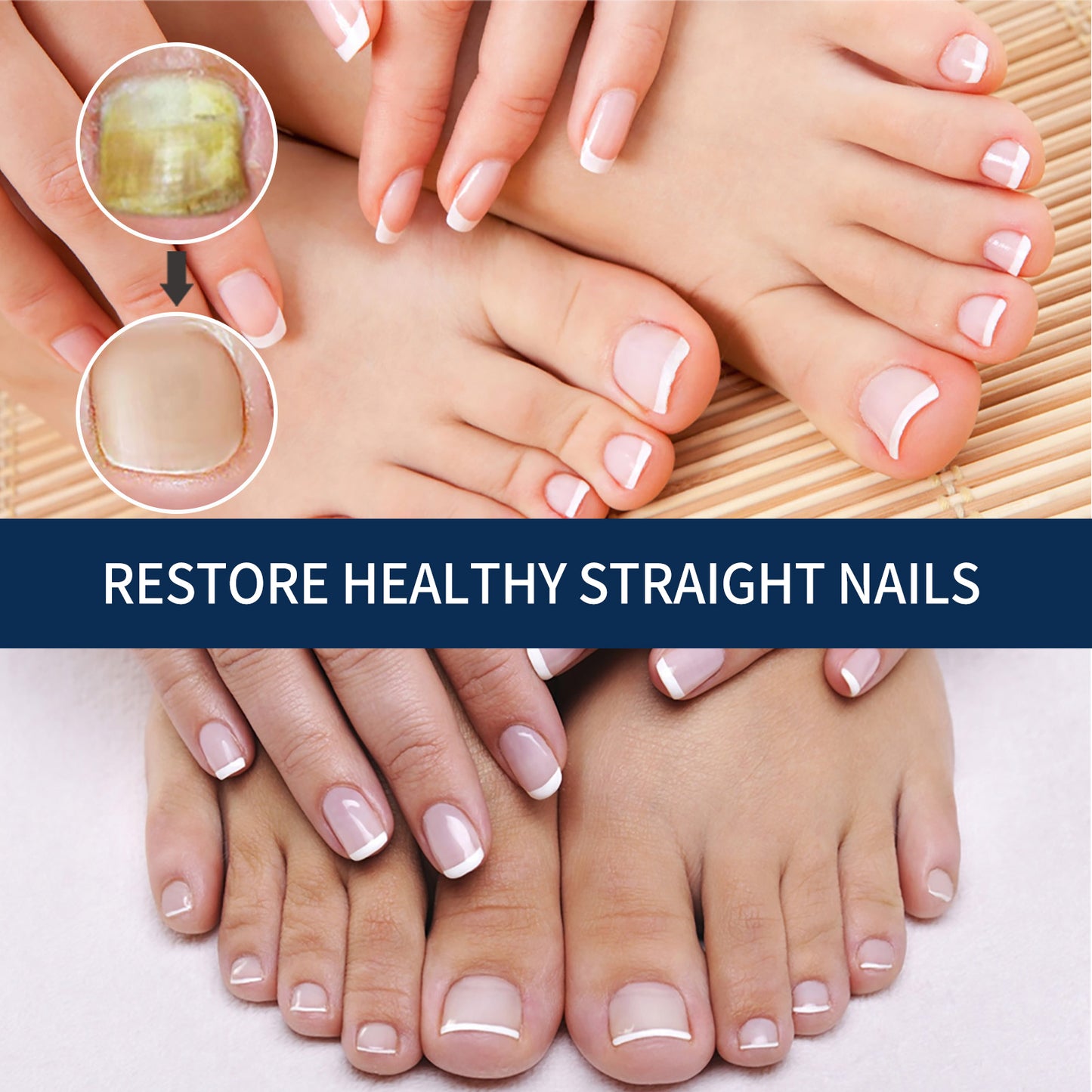 Nail Repair Essence Pen - Moisturizing Nail Treatment for Damaged Nails