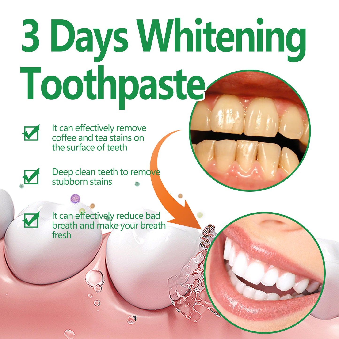 Whitening Toothpaste for Stain Removal and Gum Health - 100g