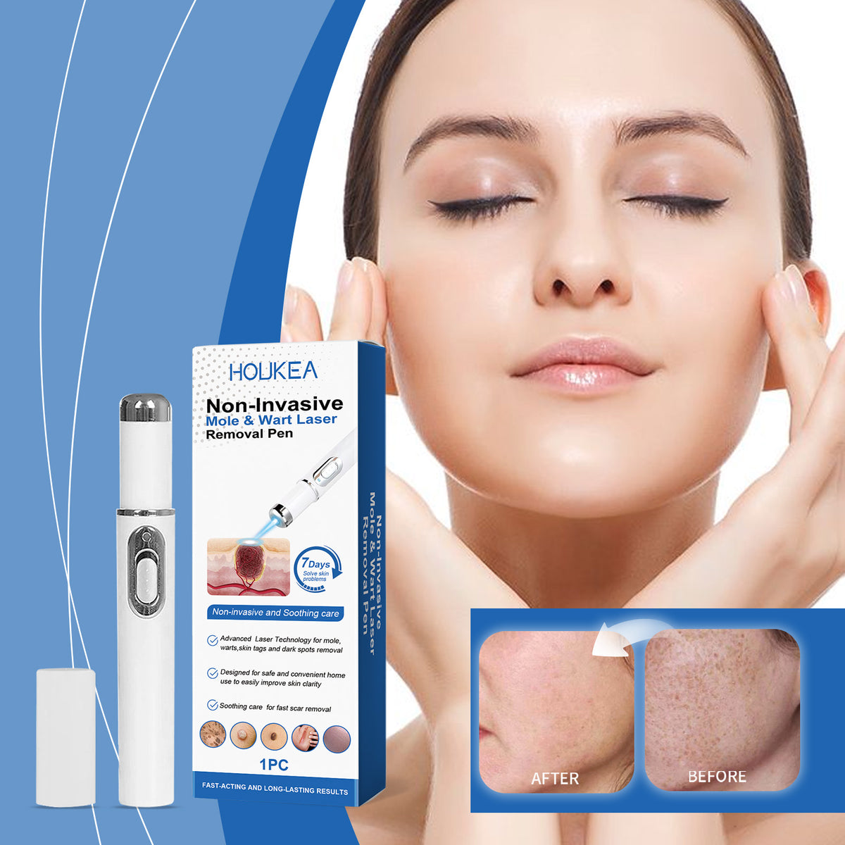 Skin Care Laser Pen