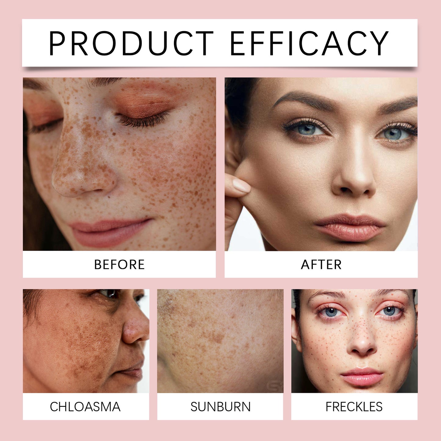 Brightening Facial Serum with Niacinamide & Arbutin - Dark Spot Corrector